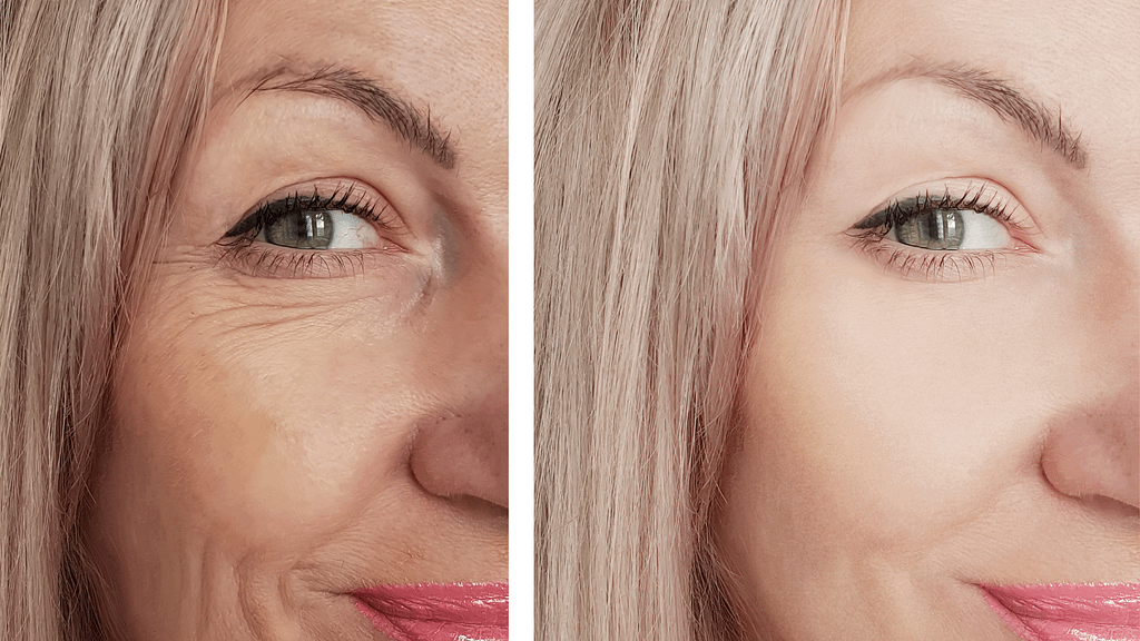 The Truth About Anti-Aging Skincare: What Works