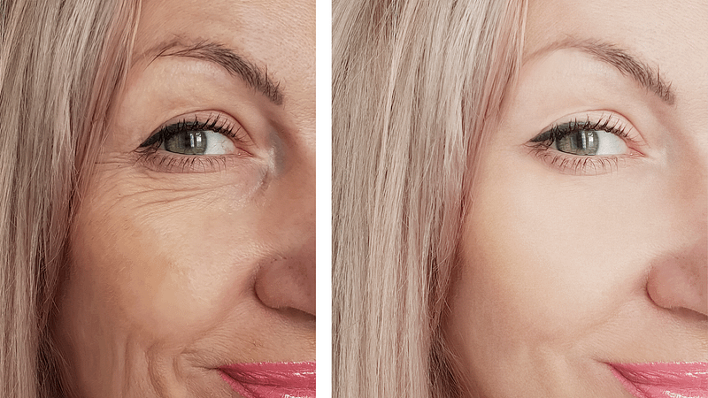 The Truth About Anti-Aging Skincare: What Works
